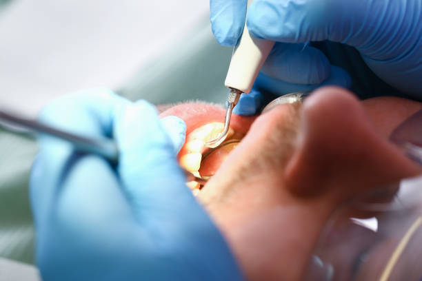 Best Emergency Treatment for Oral Infections in Brentwood, CA